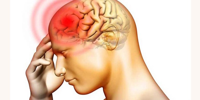 मस्तिष्कघातबाट कसरी बच्ने ?