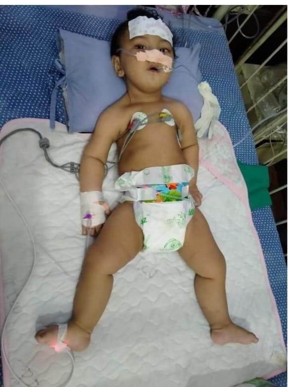 सानो नानीलाई विश्वमै दुलर्भ मानिएको रोग