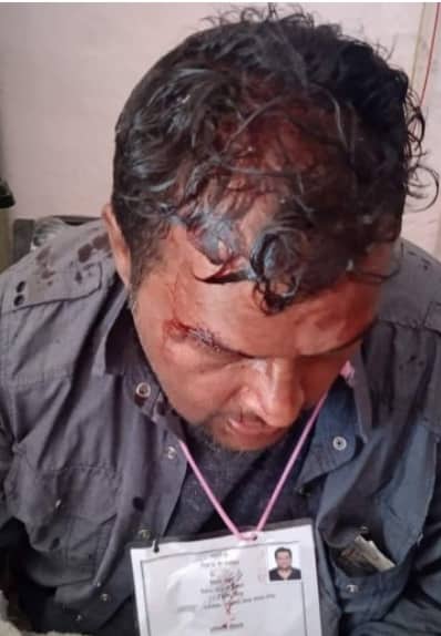 मेयरका उम्मेदवार जोशीमाथि हातपात