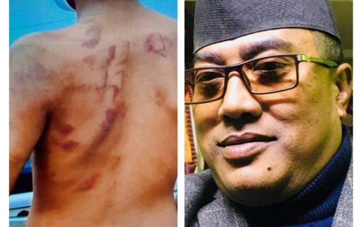 मुख छोडेको भन्दै फलामको स्केलले पिटे