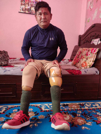 जसले माओवादी युद्धमा दुईटै खुटा गुमाए........